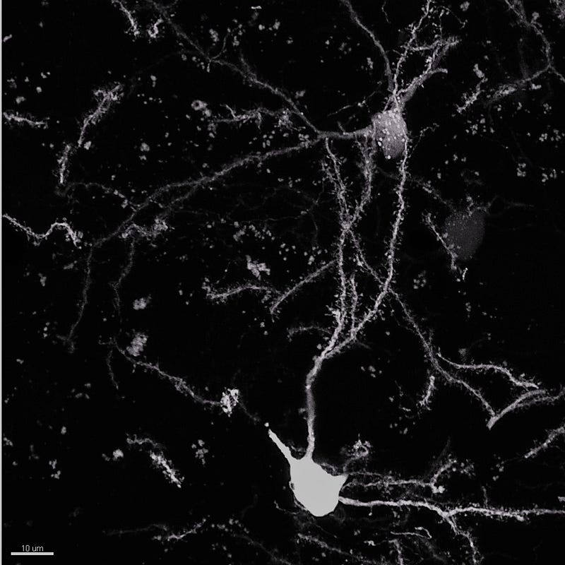 Neurons in a mouse brain, a glimpse into life’s complexity.